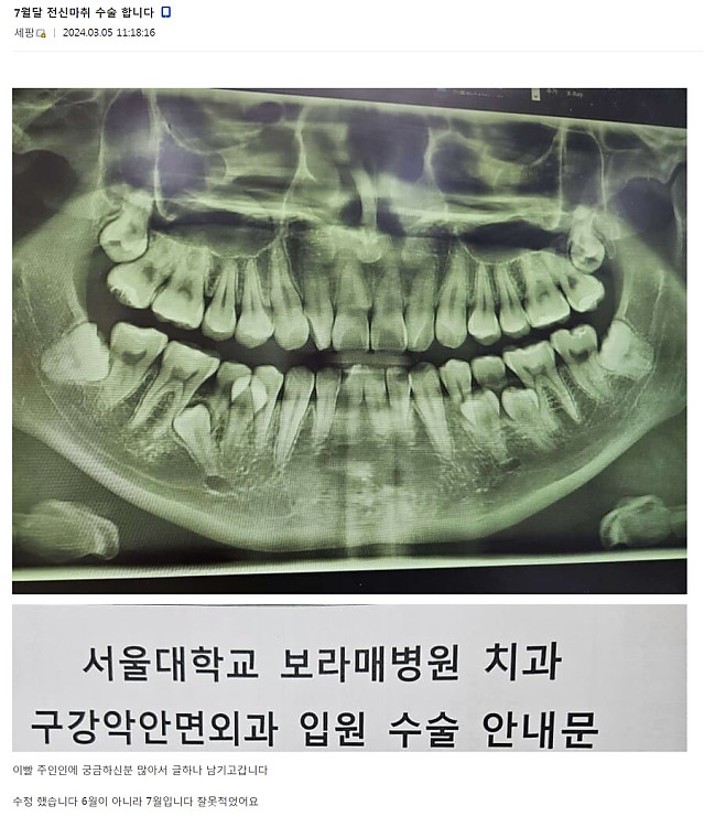 어느 사랑니갤러리의 사랑니